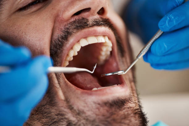 Best Dentist for Tooth Abscess  in Beaver, OK